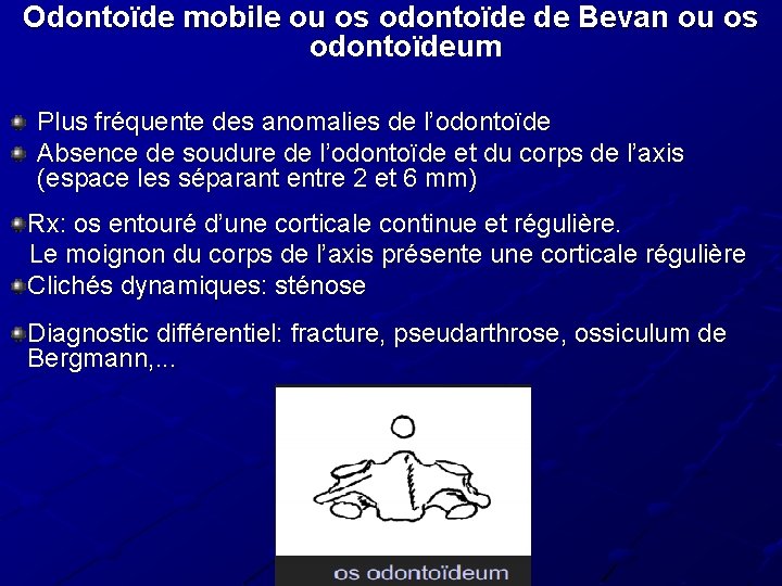 Odontoïde mobile ou os odontoïde de Bevan ou os odontoïdeum Plus fréquente des anomalies