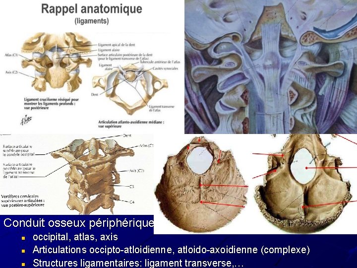 Conduit osseux périphériques: n n n occipital, atlas, axis Articulations occipto-atloidienne, atloido-axoidienne (complexe) Structures Conduit osseux périphériques: n n n occipital, atlas, axis Articulations occipto-atloidienne, atloido-axoidienne (complexe) Structures