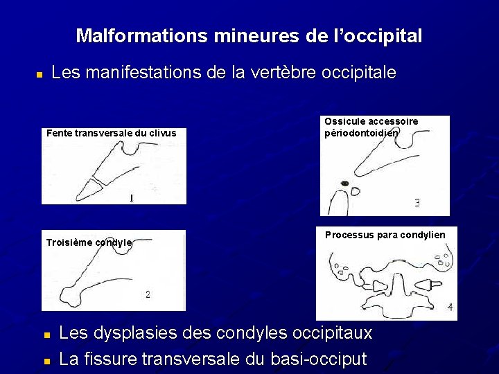Malformations mineures de l’occipital Les manifestations de la vertèbre occipitale n Fente transversale du Malformations mineures de l’occipital Les manifestations de la vertèbre occipitale n Fente transversale du
