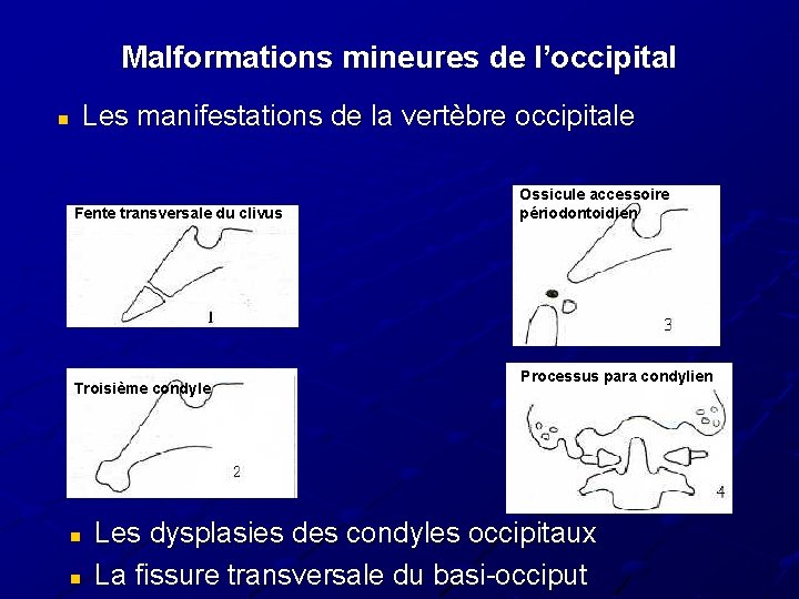 Malformations mineures de l’occipital Les manifestations de la vertèbre occipitale n Fente transversale du