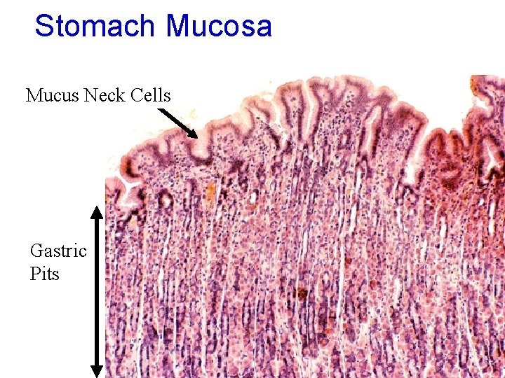 Stomach Mucosa Mucus Neck Cells Gastric Pits 26 