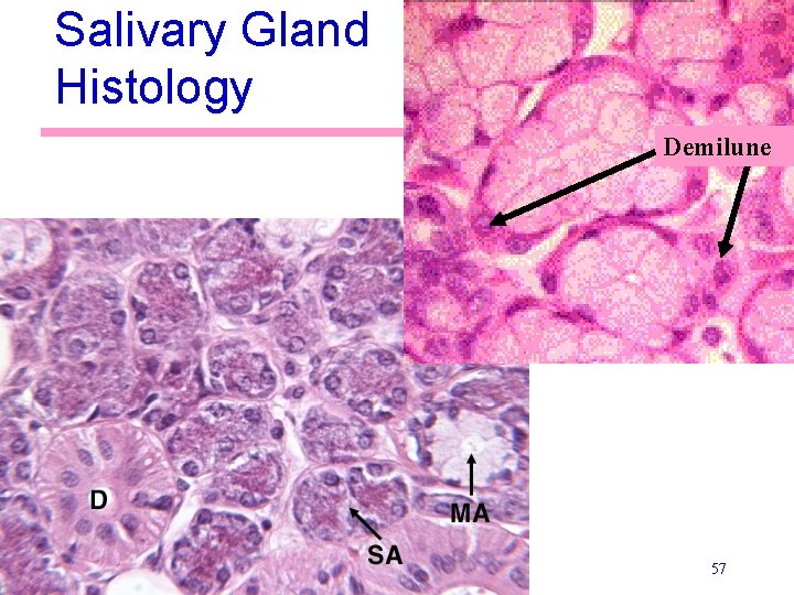 Salivary Gland Histology Demilune 57 