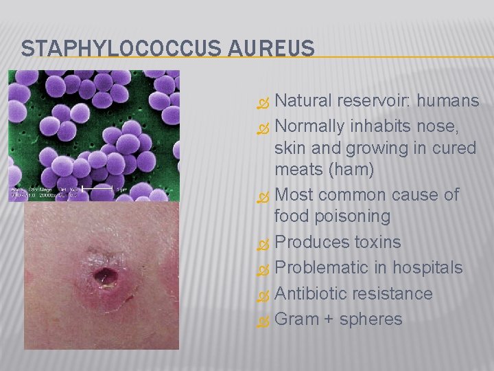 STAPHYLOCOCCUS AUREUS Natural reservoir: humans Normally inhabits nose, skin and growing in cured meats
