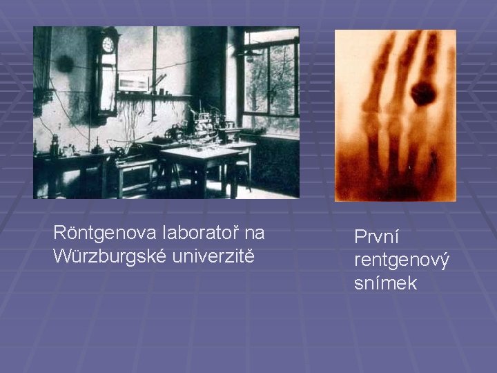 Röntgenova laboratoř na Würzburgské univerzitě První rentgenový snímek 