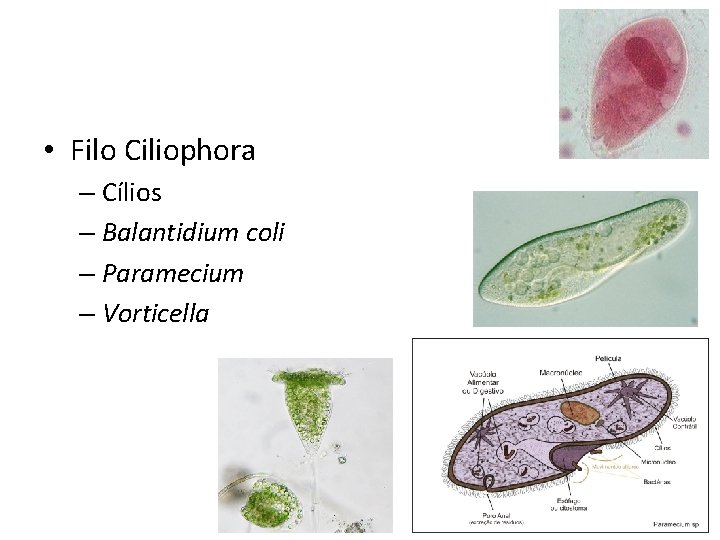  • Filo Ciliophora – Cílios – Balantidium coli – Paramecium – Vorticella 