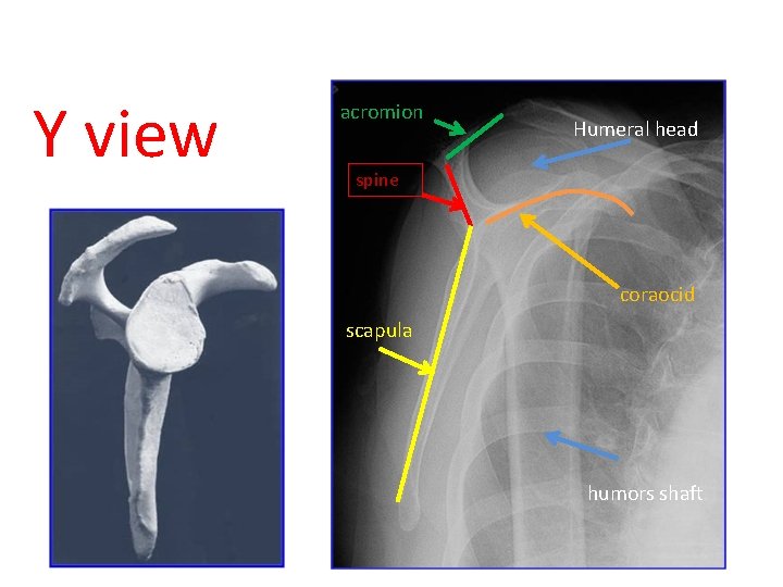 Y view acromion Humeral head spine coraocid scapula humors shaft 