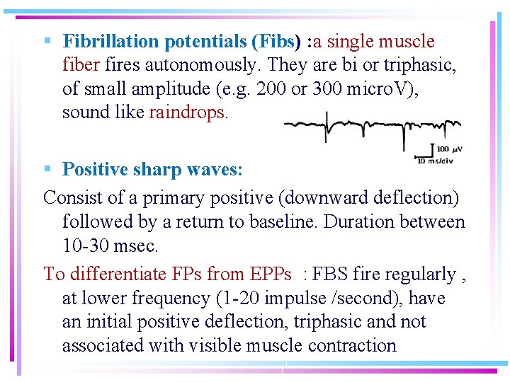 § Fibrillation potentials (Fibs) : a single muscle fiber fires autonomously. They are bi