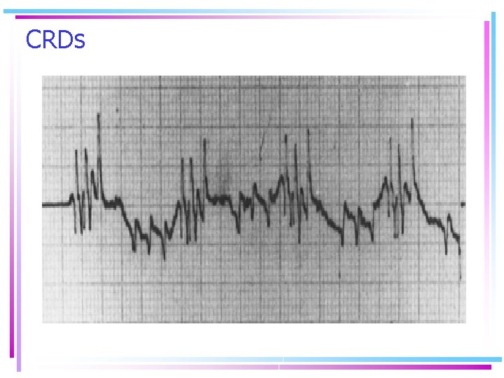 CRDs 