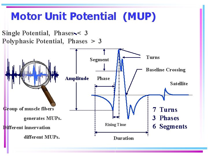 Motor Unit Potential (MUP) Single Potential, Phases < 3 Polyphasic Potential, Phases > 3