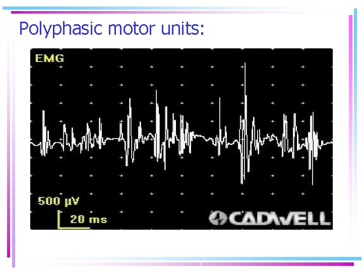 Polyphasic motor units: 