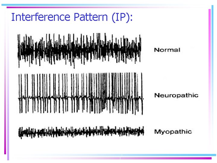 Interference Pattern (IP): 