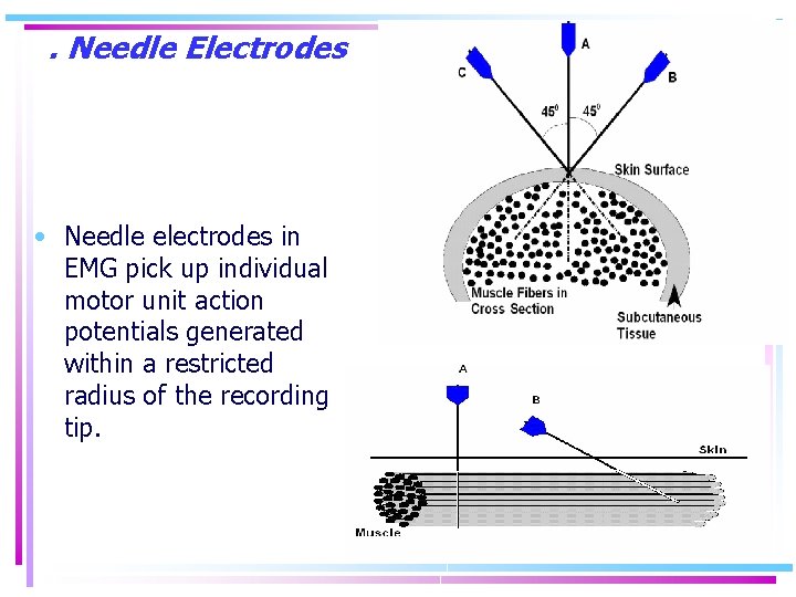 . Needle Electrodes • Needle electrodes in EMG pick up individual motor unit action