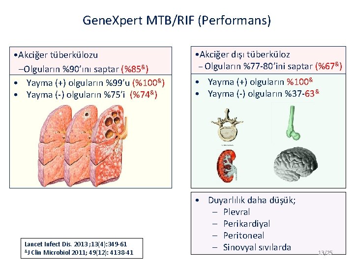 Gene. Xpert MTB/RIF (Performans) • Akciğer tüberkülozu –Olguların %90’ını saptar (%85&) • Yayma (+)