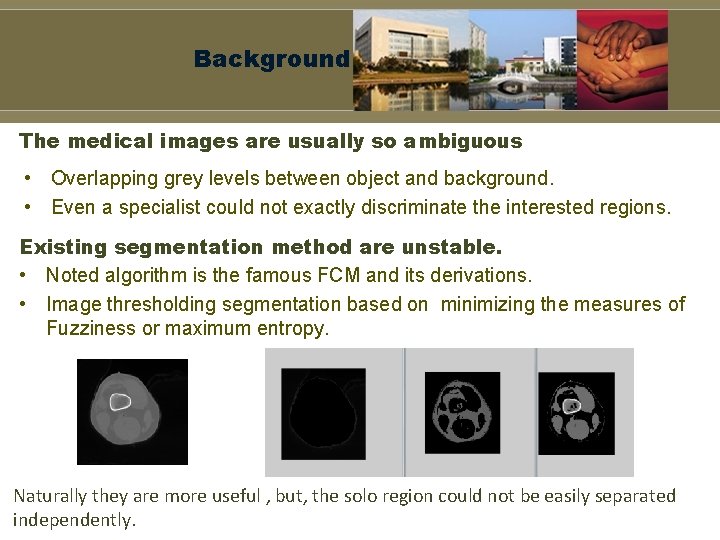 Background The medical images are usually so ambiguous • Overlapping grey levels between object