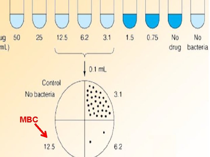 MBC 