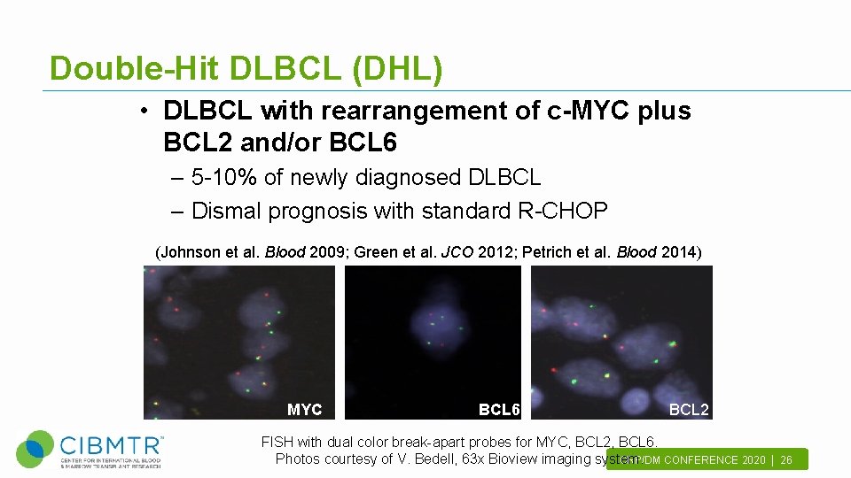 Double-Hit DLBCL (DHL) • DLBCL with rearrangement of c-MYC plus BCL 2 and/or BCL