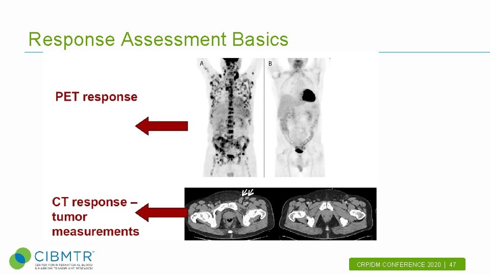 Response Assessment Basics CRP/DM CONFERENCE 2020 | 47. 