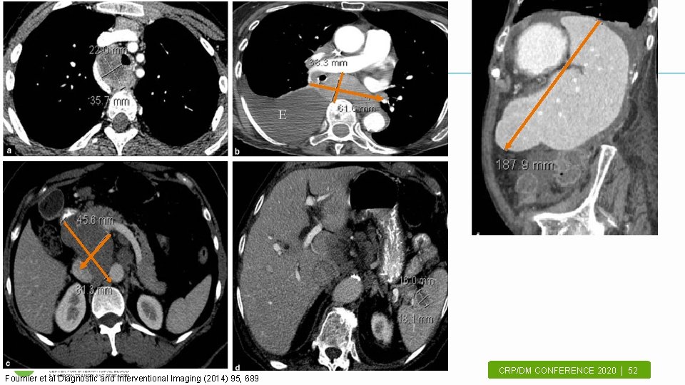 Fournier et al Diagnostic and Interventional Imaging (2014) 95, 689 CRP/DM CONFERENCE 2020 |