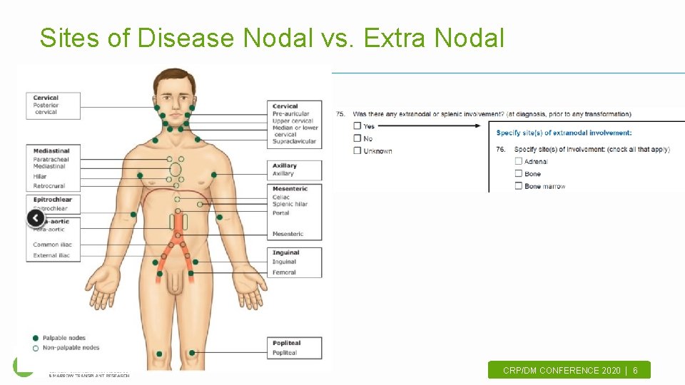 Sites of Disease Nodal vs. Extra Nodal CRP/DM CONFERENCE 2020 | 6. 