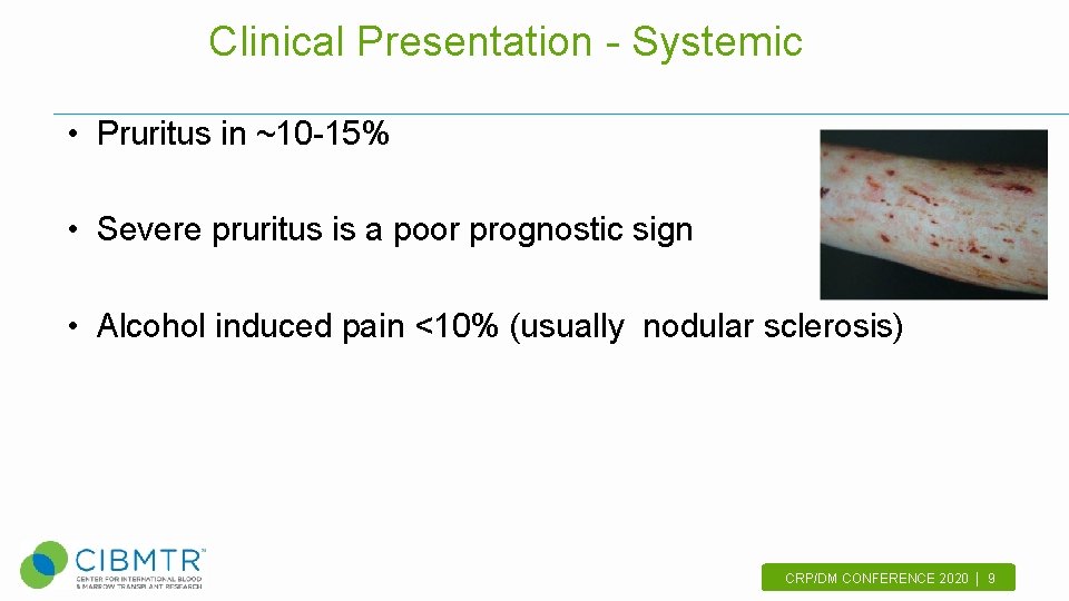 Clinical Presentation - Systemic • Pruritus in ~10 -15% • Severe pruritus is a