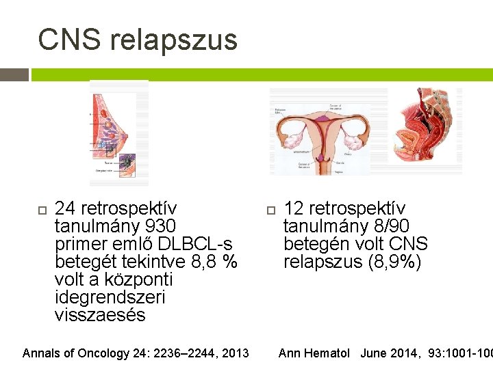 CNS relapszus 24 retrospektív tanulmány 930 primer emlő DLBCL-s betegét tekintve 8, 8 %