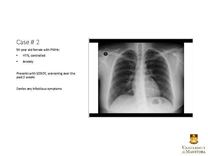 Case # 2 54 year old female with PMHx: • HTN, controlled • Anxiety