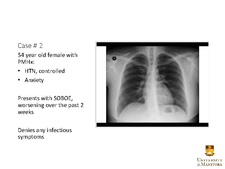 Case # 2 54 year old female with PMHx: • HTN, controlled • Anxiety