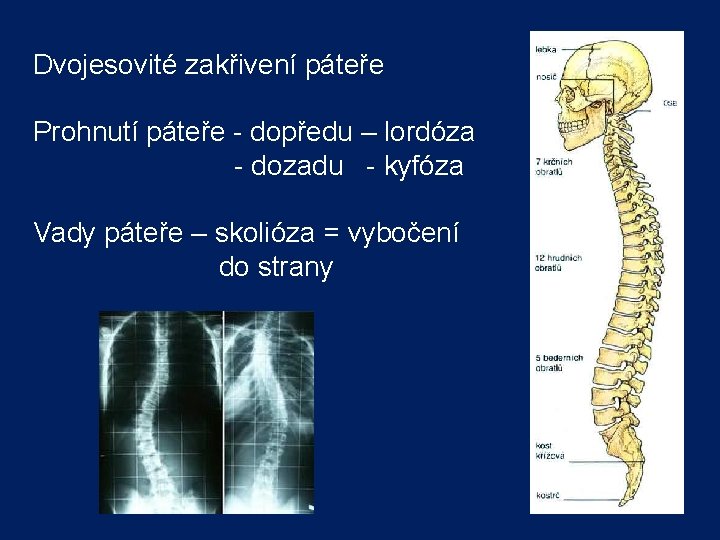 Dvojesovité zakřivení páteře Prohnutí páteře - dopředu – lordóza - dozadu - kyfóza Vady