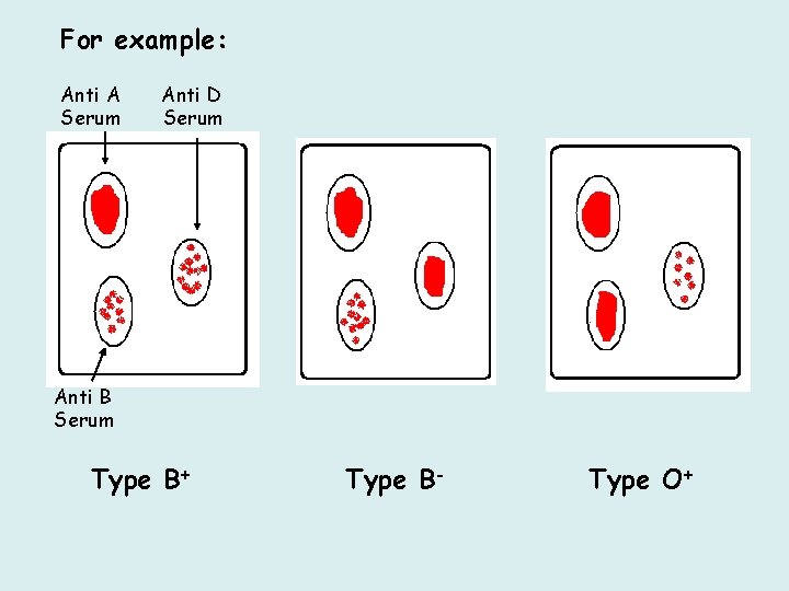 For example: Anti A Serum Anti D Serum Anti B Serum Type B+ Type