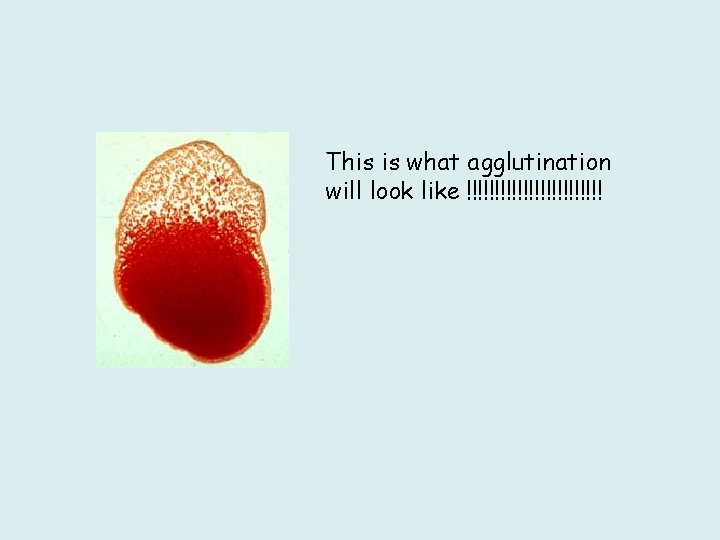 This is what agglutination will look like !!!!!!!!!!!! 