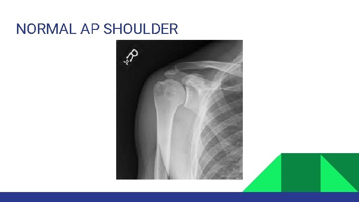 NORMAL AP SHOULDER 