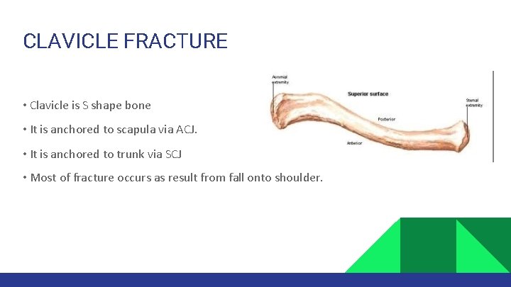 CLAVICLE FRACTURE • Clavicle is S shape bone • It is anchored to scapula