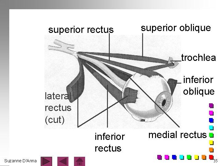 superior rectus superior oblique trochlea inferior oblique lateral rectus (cut) inferior rectus Suzanne D'Anna