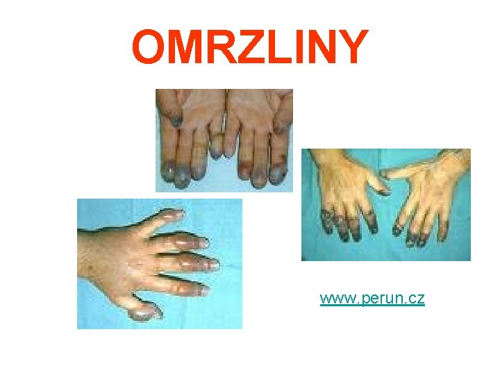 OMRZLINY www. perun. cz 