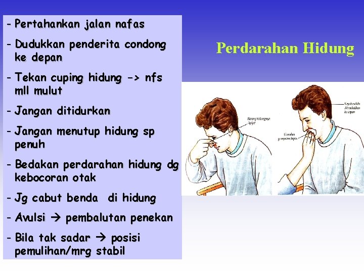 - Pertahankan jalan nafas - Dudukkan penderita condong ke depan - Tekan cuping hidung