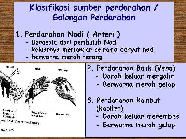 Klasifikasi sumber perdarahan / Golongan Perdarahan 1. Perdarahan Nadi ( Arteri ) - Berasala