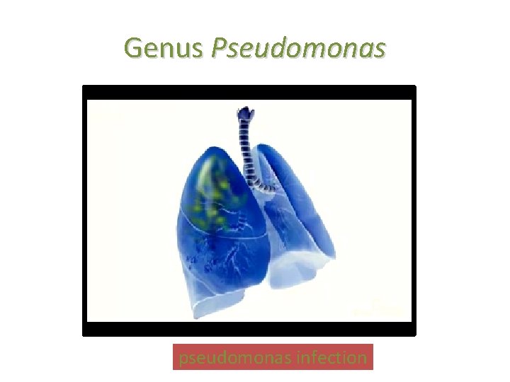 Genus Pseudomonas pseudomonas infection 