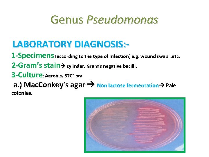 Genus Pseudomonas LABORATORY DIAGNOSIS: - 1 -Specimens (according to the type of infection) e.