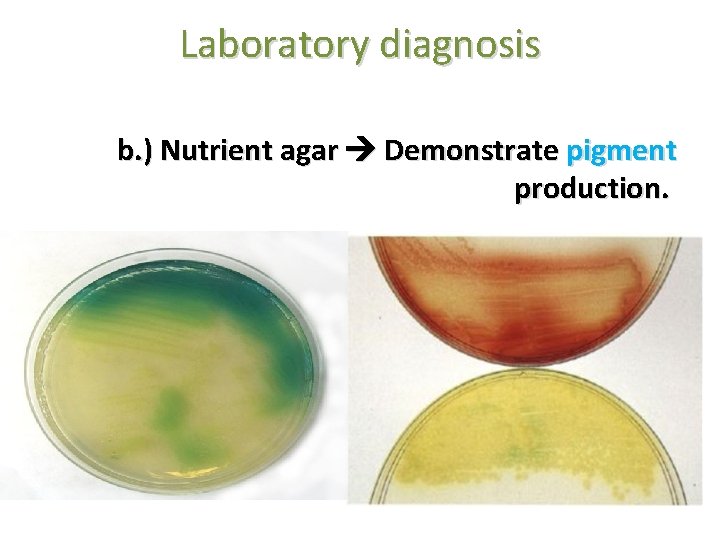 Laboratory diagnosis b. ) Nutrient agar Demonstrate pigment production. 