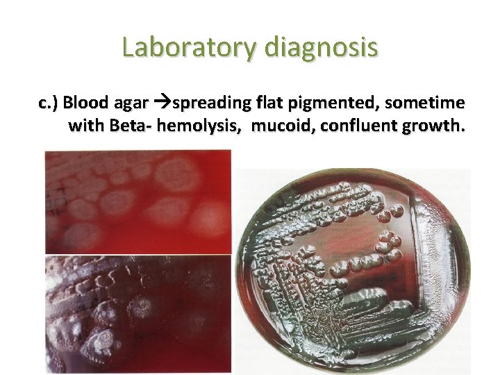 Laboratory diagnosis c. ) Blood agar spreading flat pigmented, sometime with Beta- hemolysis, mucoid,