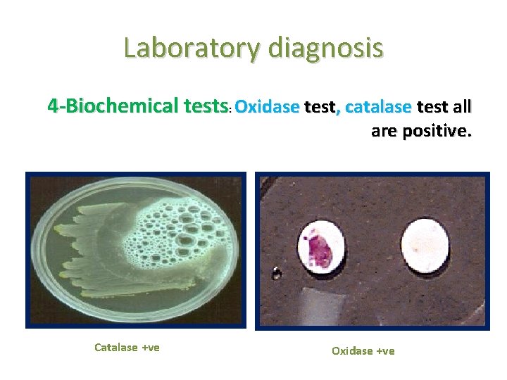 Laboratory diagnosis 4 -Biochemical tests: Oxidase test, catalase test all are positive. Catalase +ve