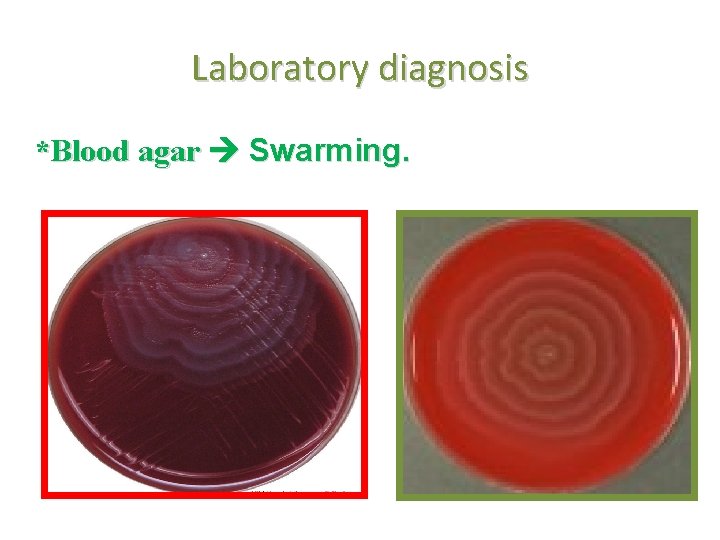 Laboratory diagnosis *Blood agar Swarming. 