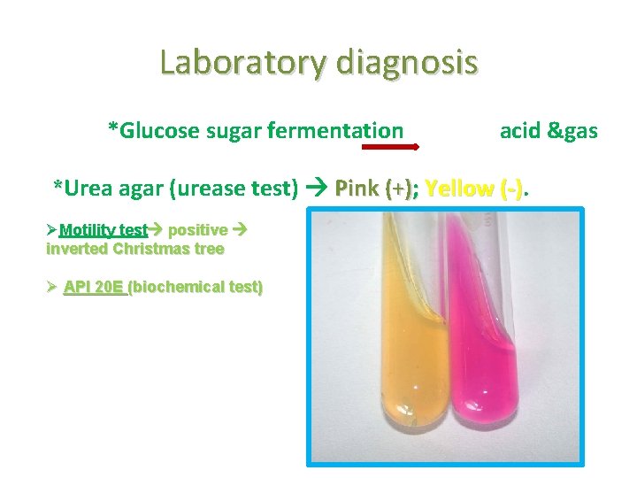 Laboratory diagnosis *Glucose sugar fermentation acid &gas *Urea agar (urease test) Pink (+); Yellow