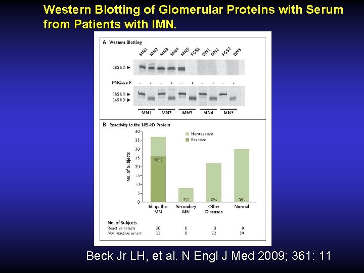 Western Blotting of Glomerular Proteins with Serum from Patients with IMN. Beck Jr LH,