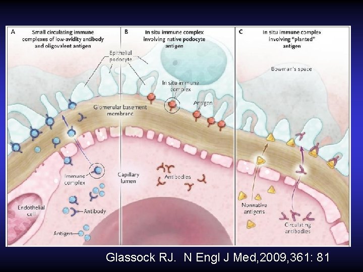 Glassock RJ. N Engl J Med, 2009, 361: 81 