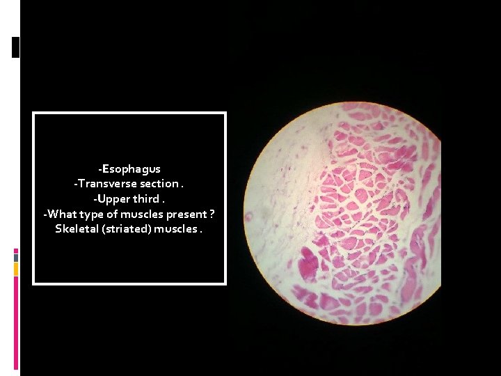 -Esophagus -Transverse section. -Upper third. -What type of muscles present ? Skeletal (striated) muscles.