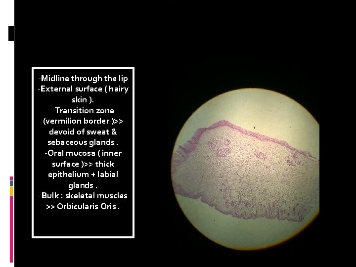 -Midline through the lip -External surface ( hairy skin ). -Transition zone (vermilion border