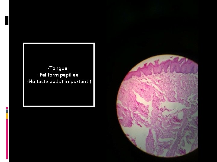 -Tongue. -Faliform papillae. -No taste buds ( important ) 