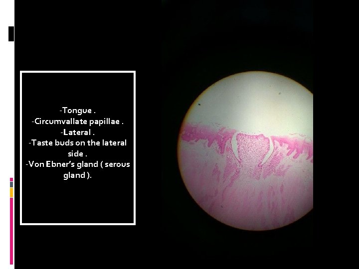 -Tongue. -Circumvallate papillae. -Lateral. -Taste buds on the lateral side. -Von Ebner’s gland (