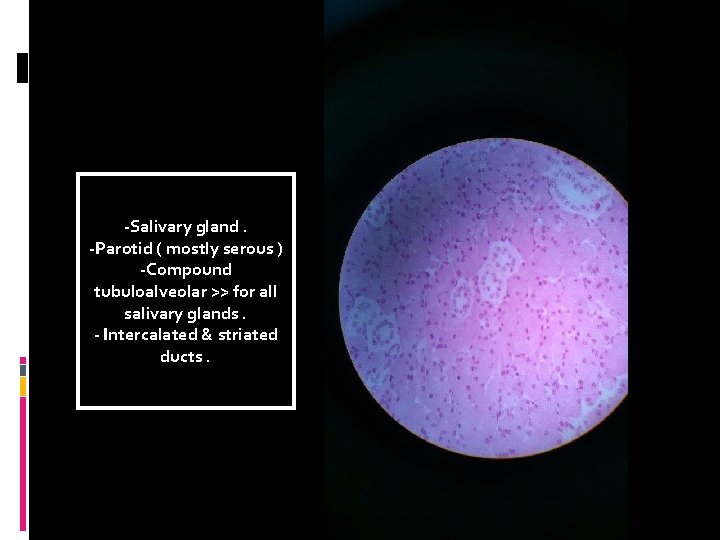 -Salivary gland. -Parotid ( mostly serous ) -Compound tubuloalveolar >> for all salivary glands.